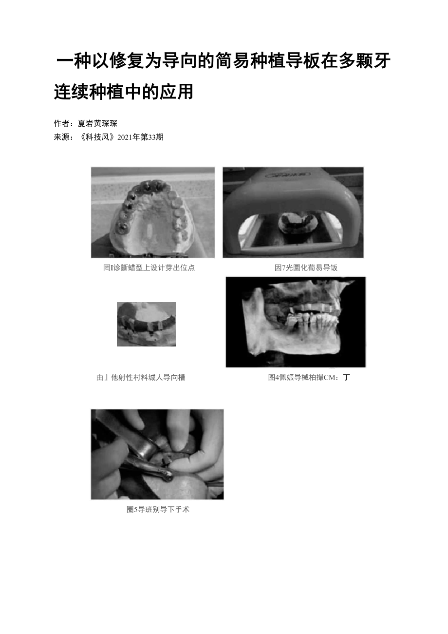 一种以修复为导向的简易种植导板在多颗牙连续种植中的应用_第1页