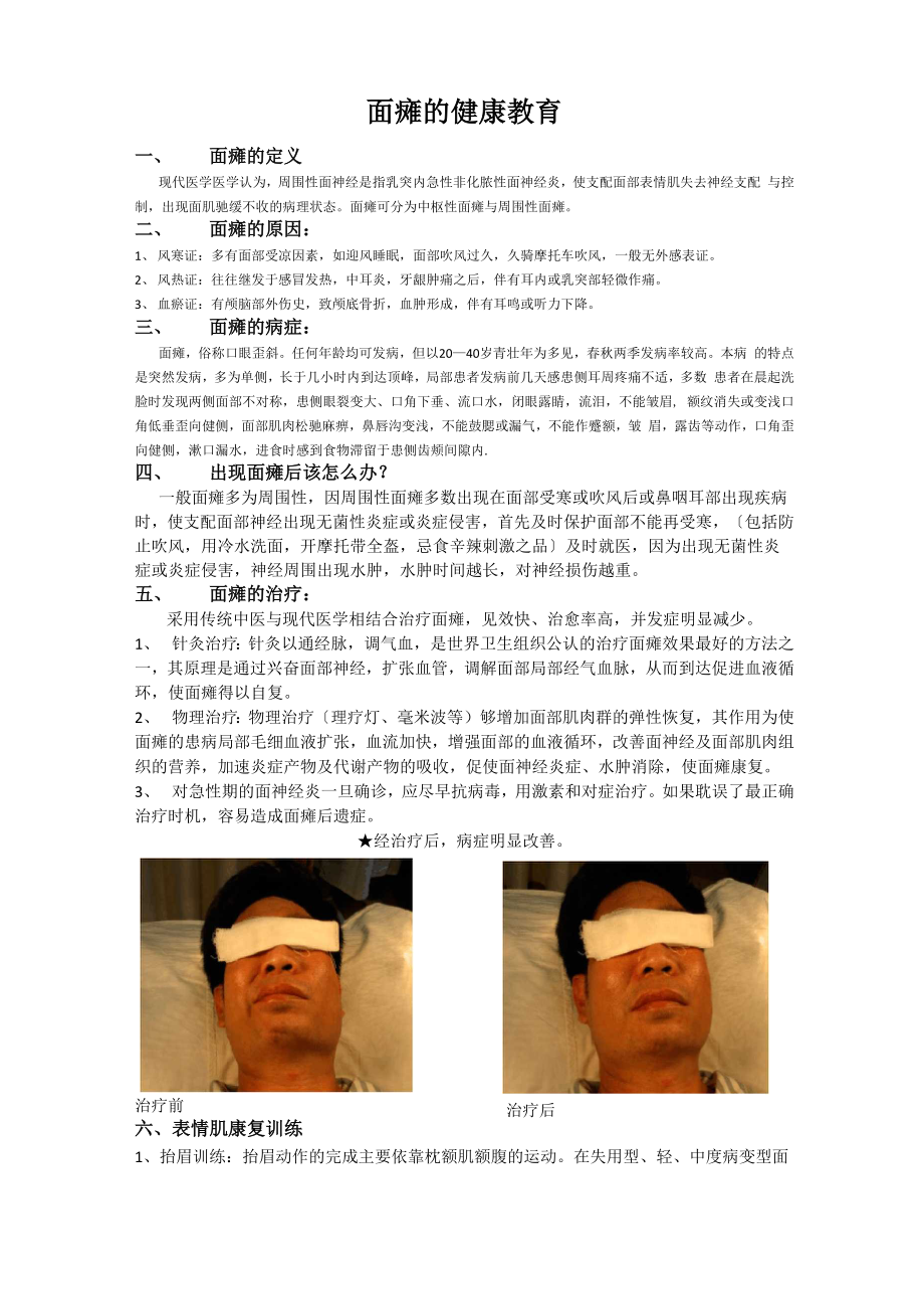 面瘫的健康宣教_第1页