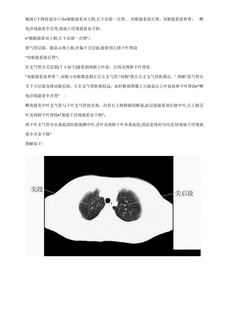 胸部CT肺段划分口诀_第1页